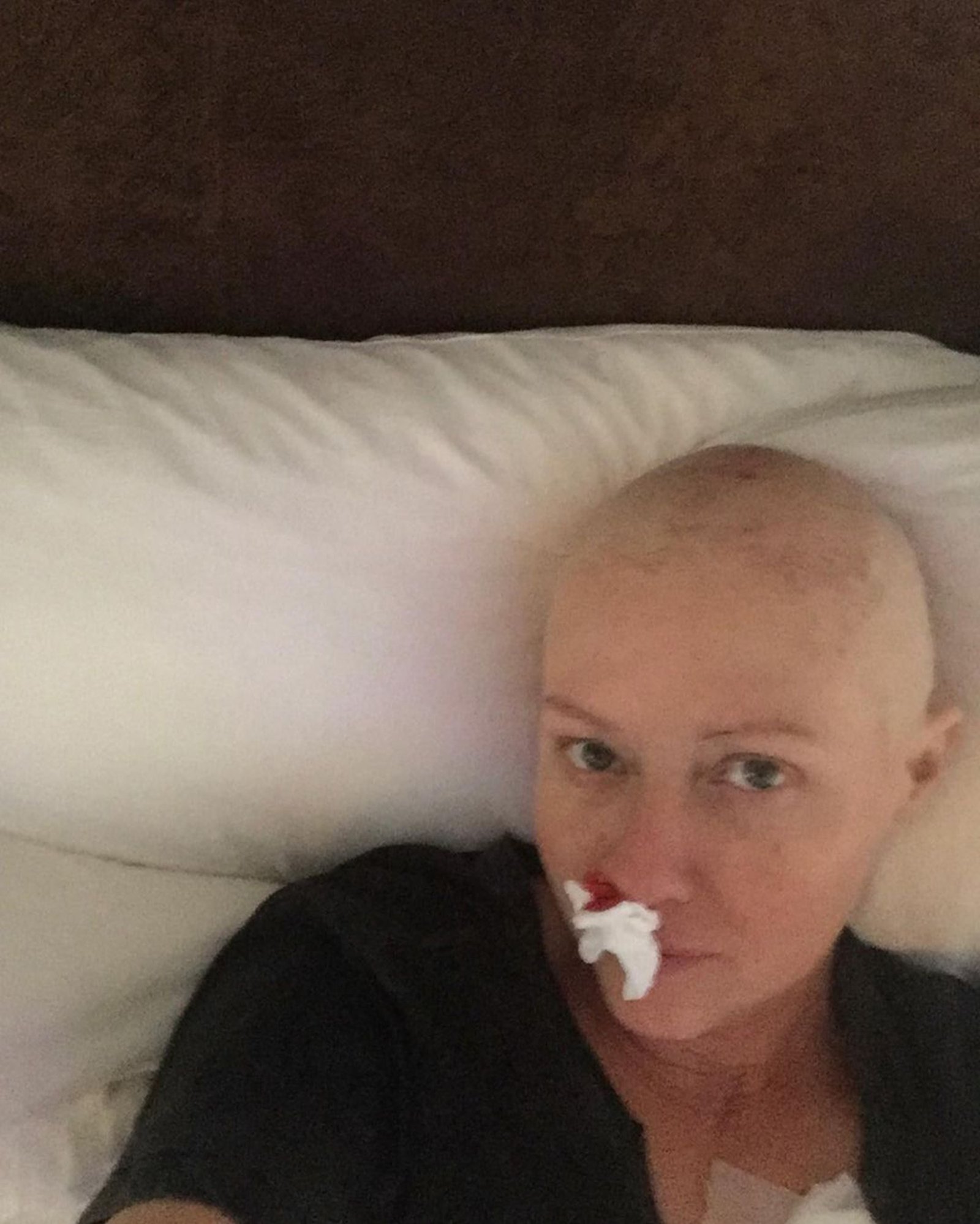 bald shannen doherty wtih nose bleed
